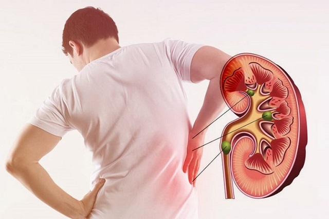 Piles Treatment